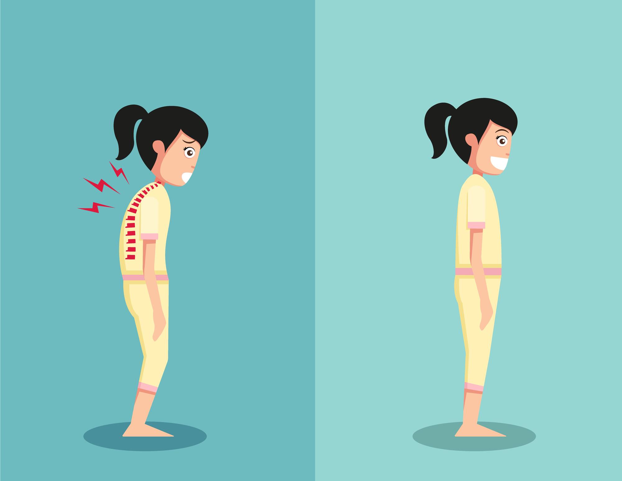 Cartoon drawing of a girl standing with her back bent forward and then the same girl standing with her back straight in the correct posture.